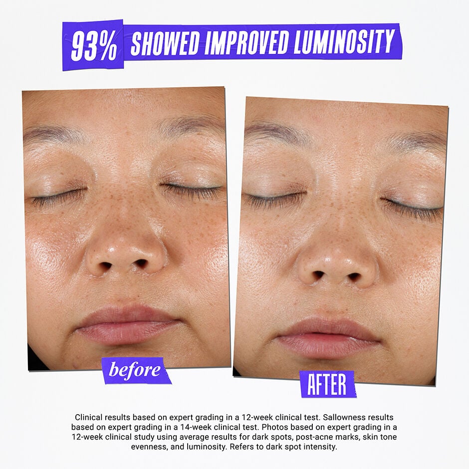 Clearly Corrective Dark Spot Solution - Dark Spot Serum